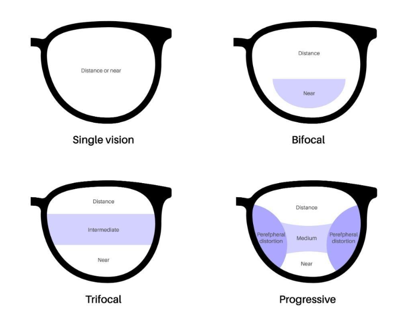 Different types of lenes found in glasses, including Single Vision, Bifocal, Trifocal, and Progressive